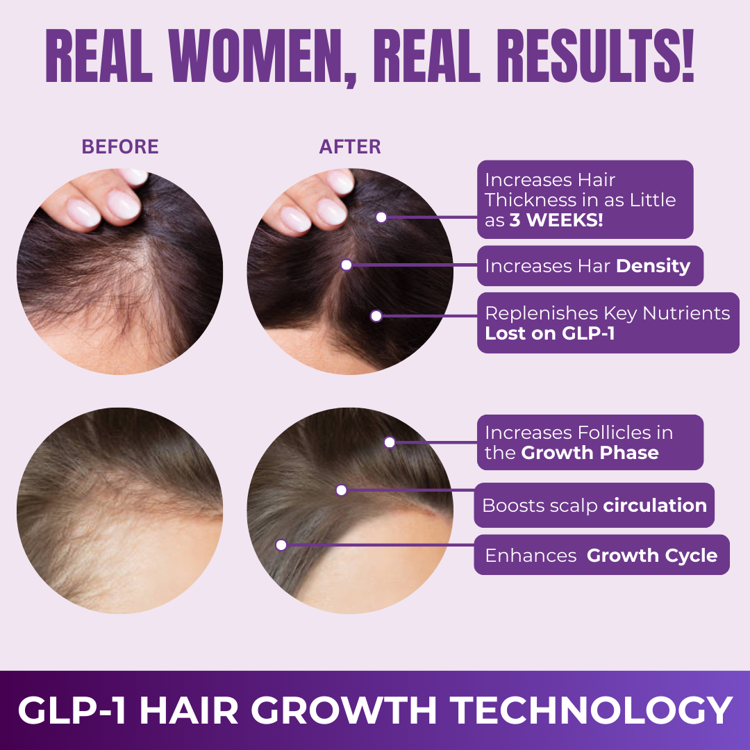 Hair Growth Accelerator Capsules & Soft Chews