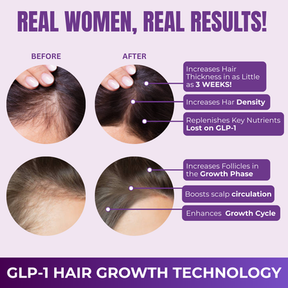 Hair Growth Accelerator Capsules & Soft Chews