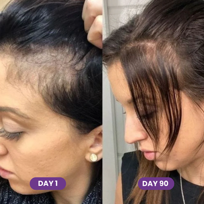 Hair Growth Accelerator Capsules & Soft Chews