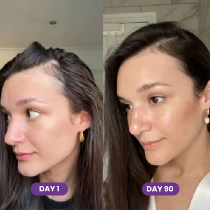 Hair Growth Accelerator Capsules & Soft Chews